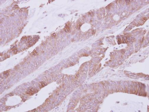 Atpalpha Antibody in Immunohistochemistry (Paraffin) (IHC (P))