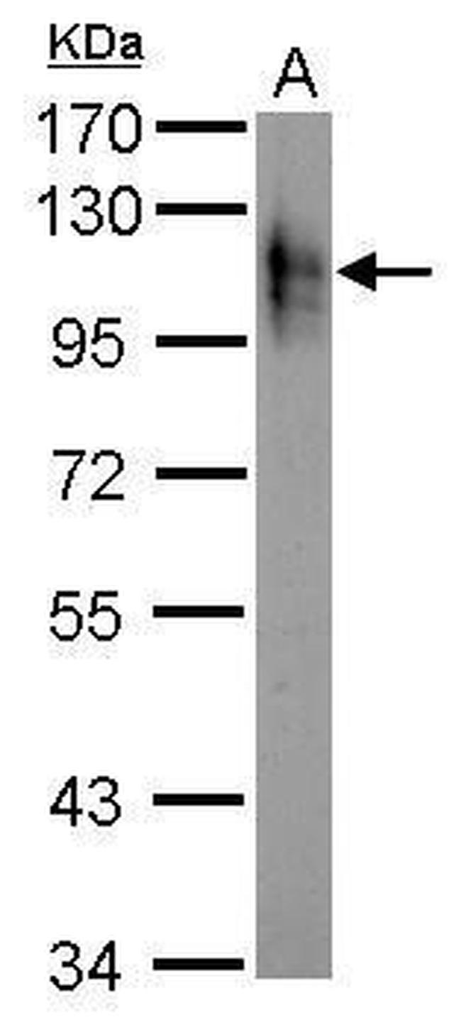 Atpalpha Antibody in Western Blot (WB)