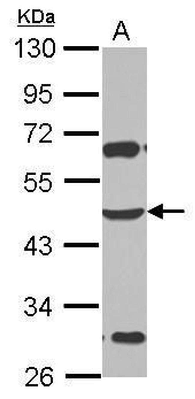 ZSCAN4 Antibody in Western Blot (WB)