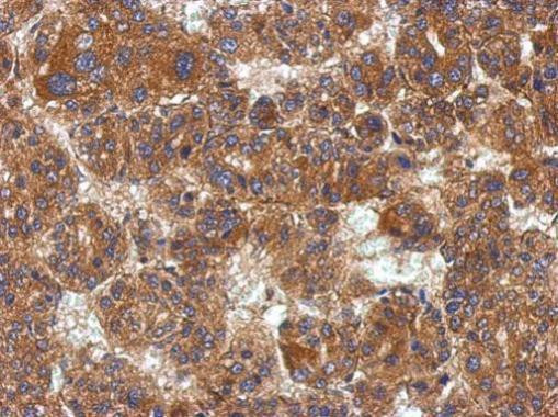 KCTD19 Antibody in Immunohistochemistry (Paraffin) (IHC (P))