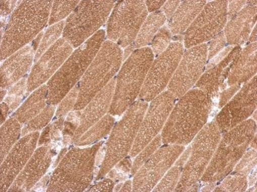 KCTD19 Antibody in Immunohistochemistry (Paraffin) (IHC (P))