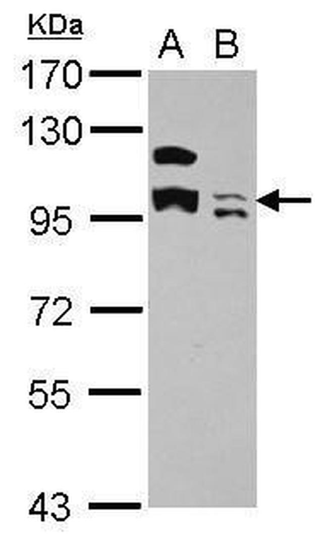KCTD19 Antibody in Western Blot (WB)