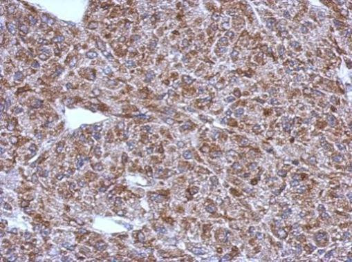 ACSM1 Antibody in Immunohistochemistry (Paraffin) (IHC (P))