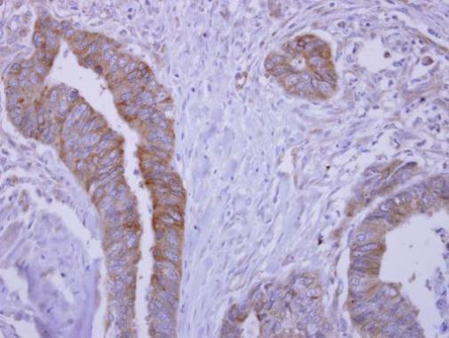 SLA/LP Antibody in Immunohistochemistry (Paraffin) (IHC (P))