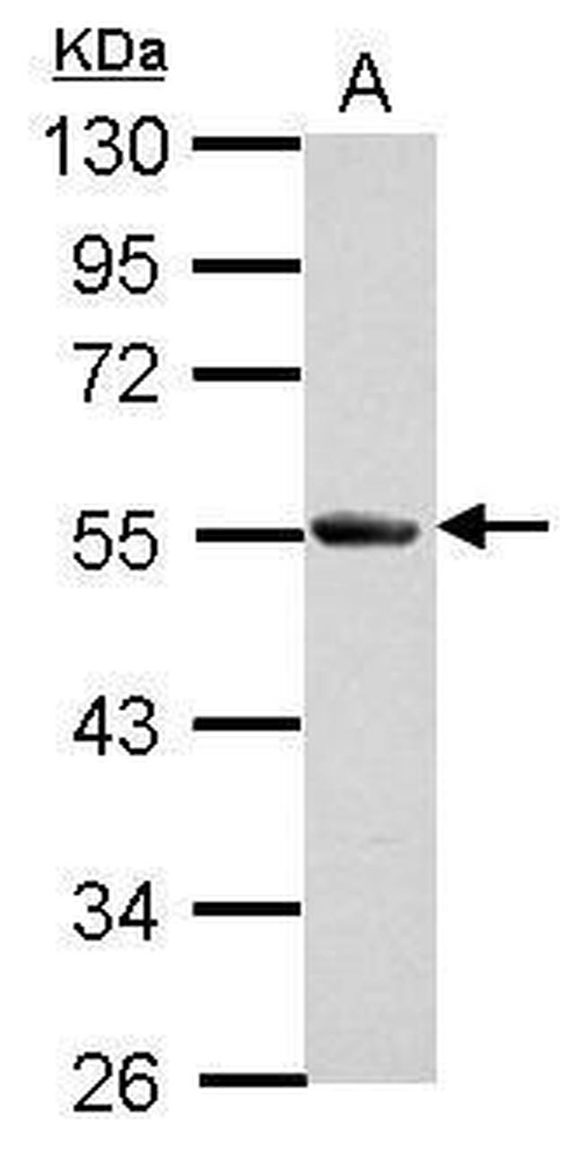 SLA/LP Antibody in Western Blot (WB)