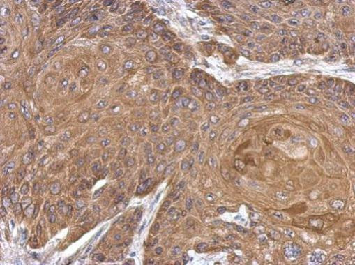 ALDH1A1 Antibody in Immunohistochemistry (Paraffin) (IHC (P))