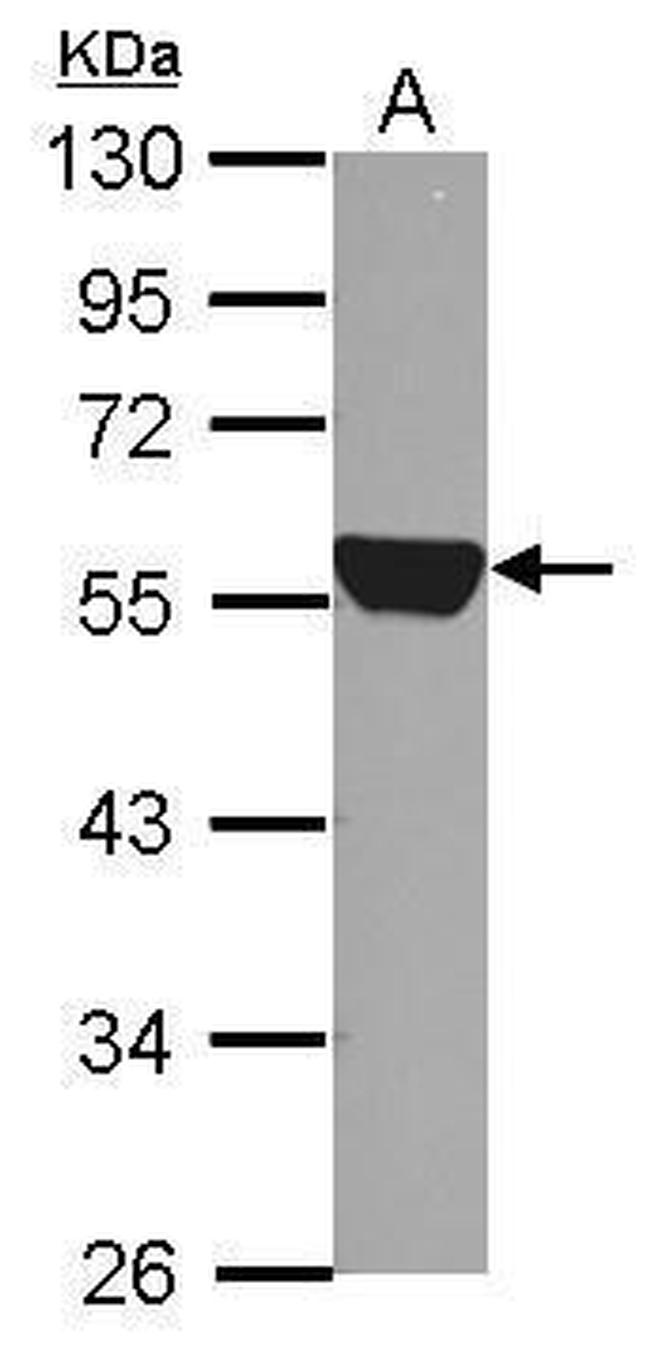 ALDH1A1 Antibody in Western Blot (WB)