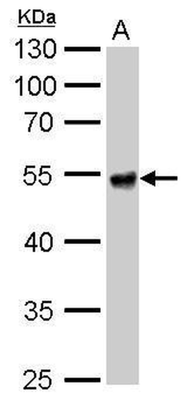 ALDH1A1 Antibody in Western Blot (WB)