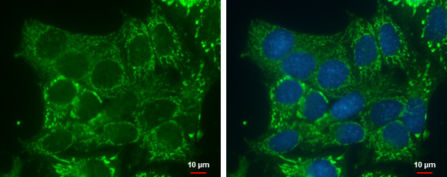 DHRS2 Antibody in Immunocytochemistry (ICC/IF)