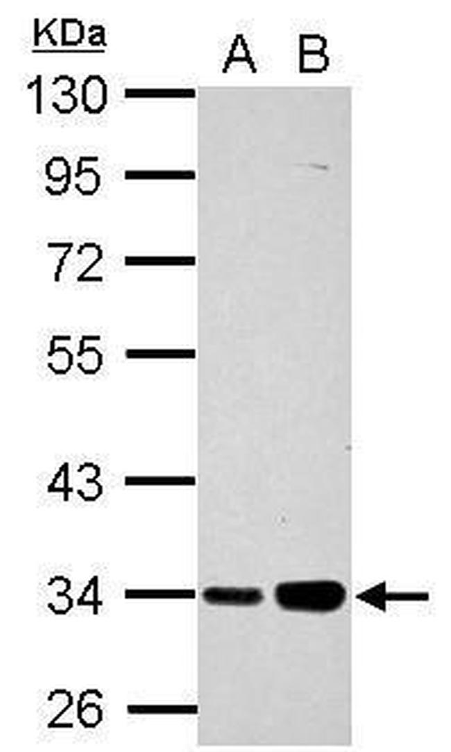 PARP16 Antibody in Western Blot (WB)