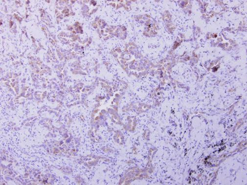 OXSM Antibody in Immunohistochemistry (Paraffin) (IHC (P))