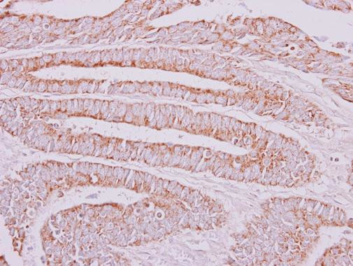 OXSM Antibody in Immunohistochemistry (Paraffin) (IHC (P))