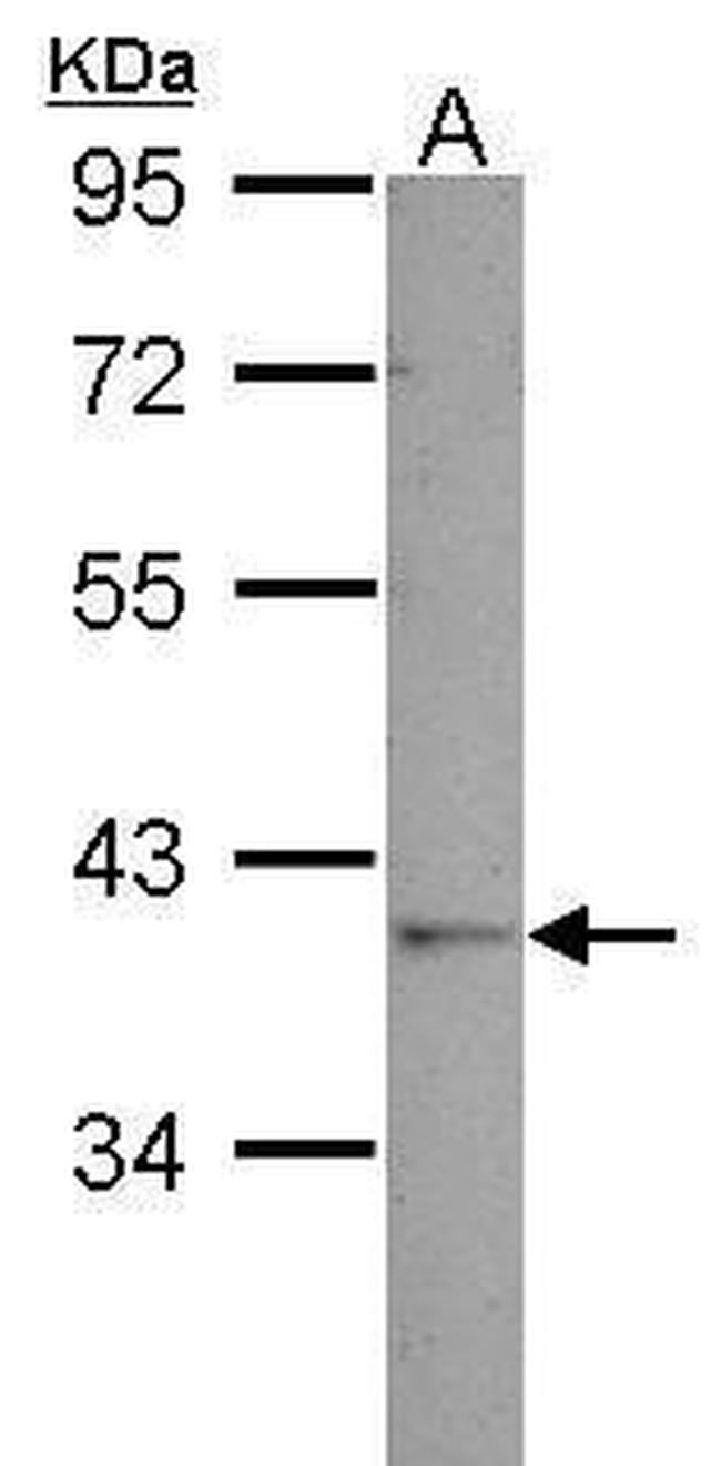 GALM Antibody in Western Blot (WB)