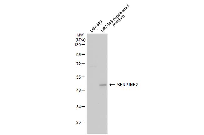 SERPINE2 Antibody in Western Blot (WB)