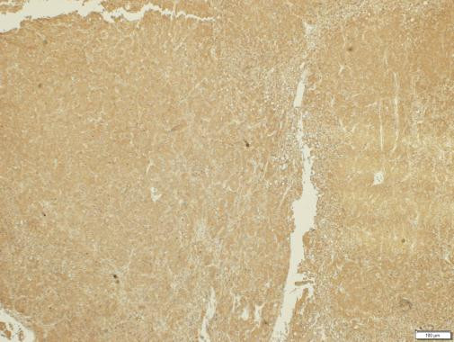 ADAMTS5 Antibody in Immunohistochemistry (Paraffin) (IHC (P))