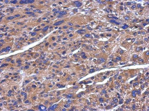 ADAMTS5 Antibody in Immunohistochemistry (Paraffin) (IHC (P))