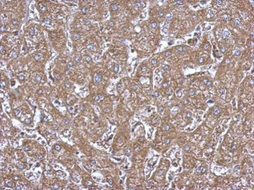 ALDH1A1 Antibody in Immunohistochemistry (Paraffin) (IHC (P))