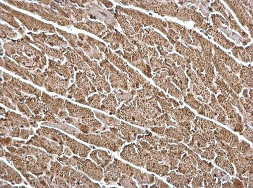 FHL1 Antibody in Immunohistochemistry (Paraffin) (IHC (P))