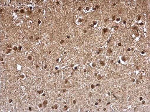 FHL1 Antibody in Immunohistochemistry (Paraffin) (IHC (P))