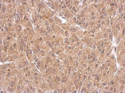 FHL1 Antibody in Immunohistochemistry (Paraffin) (IHC (P))