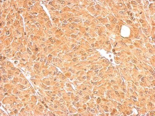 GALM Antibody in Immunohistochemistry (Paraffin) (IHC (P))