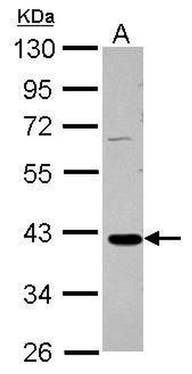 GALM Antibody in Western Blot (WB)