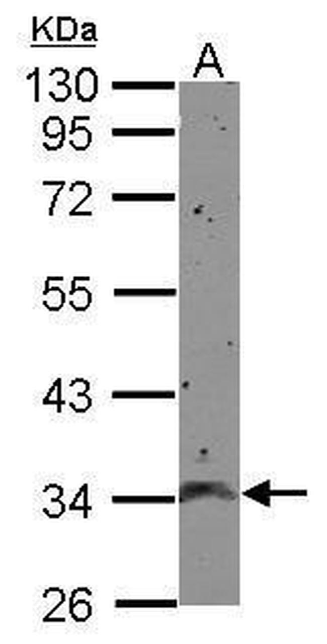 CCDC90A Antibody in Western Blot (WB)