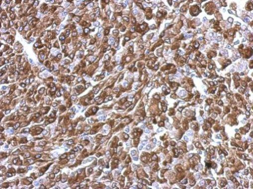 KIFC2 Antibody in Immunohistochemistry (Paraffin) (IHC (P))