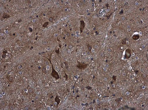 KIFC2 Antibody in Immunohistochemistry (Paraffin) (IHC (P))