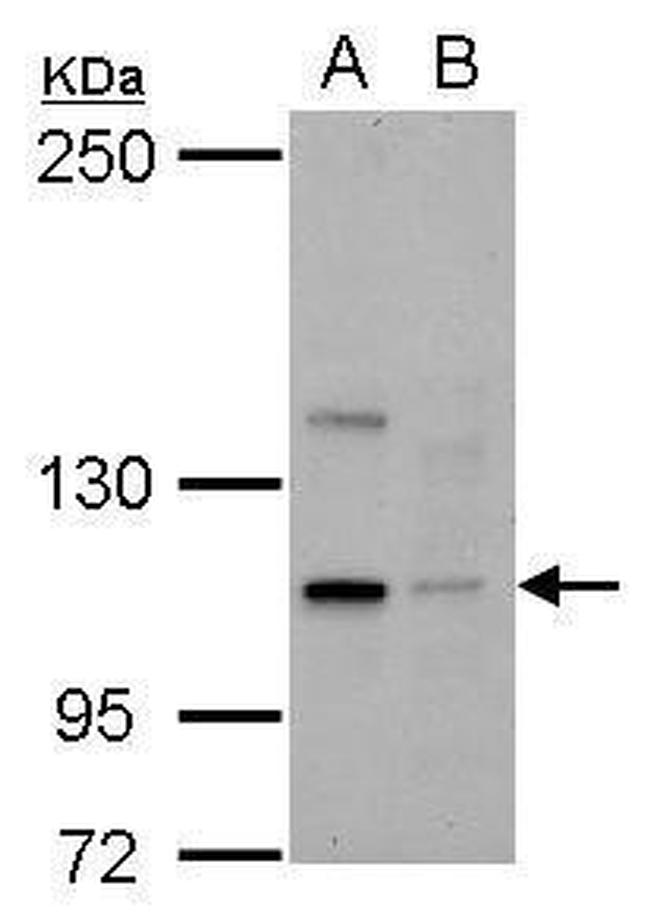 KIFC2 Antibody in Western Blot (WB)