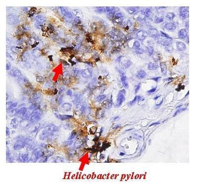 Helicobacter pylori Urease B Antibody in Immunohistochemistry (Paraffin) (IHC (P))