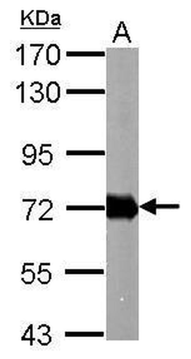 Helicobacter pylori Urease B Antibody in Western Blot (WB)