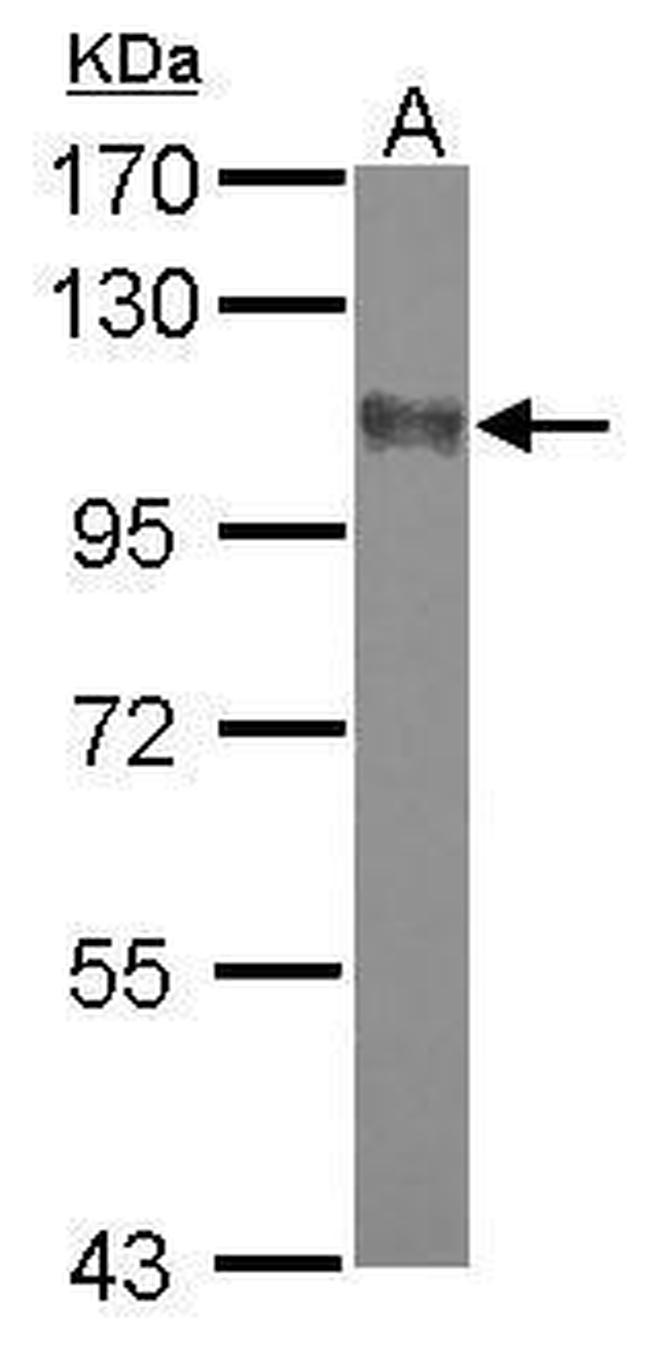 SAPAP2 Antibody in Western Blot (WB)