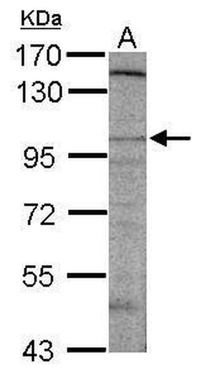 SAPAP2 Antibody in Western Blot (WB)