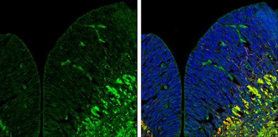 ZPK Antibody in Immunohistochemistry (Frozen) (IHC (F))