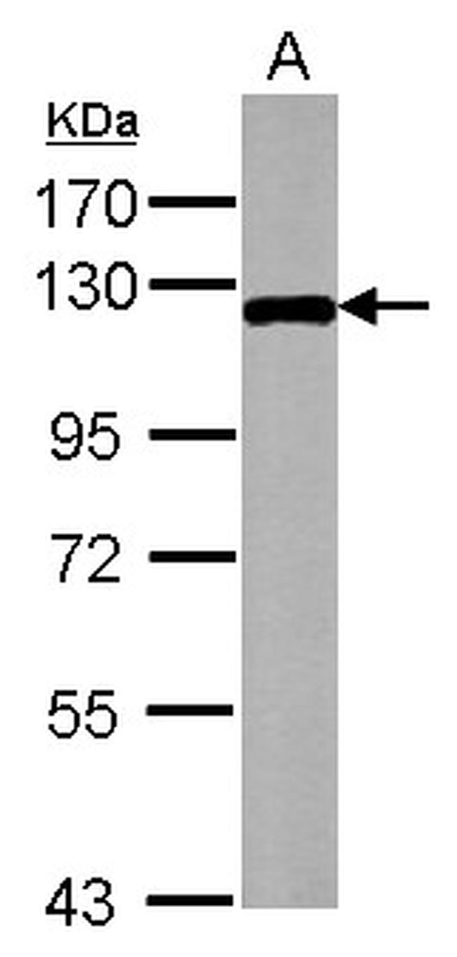 ZPK Antibody in Western Blot (WB)