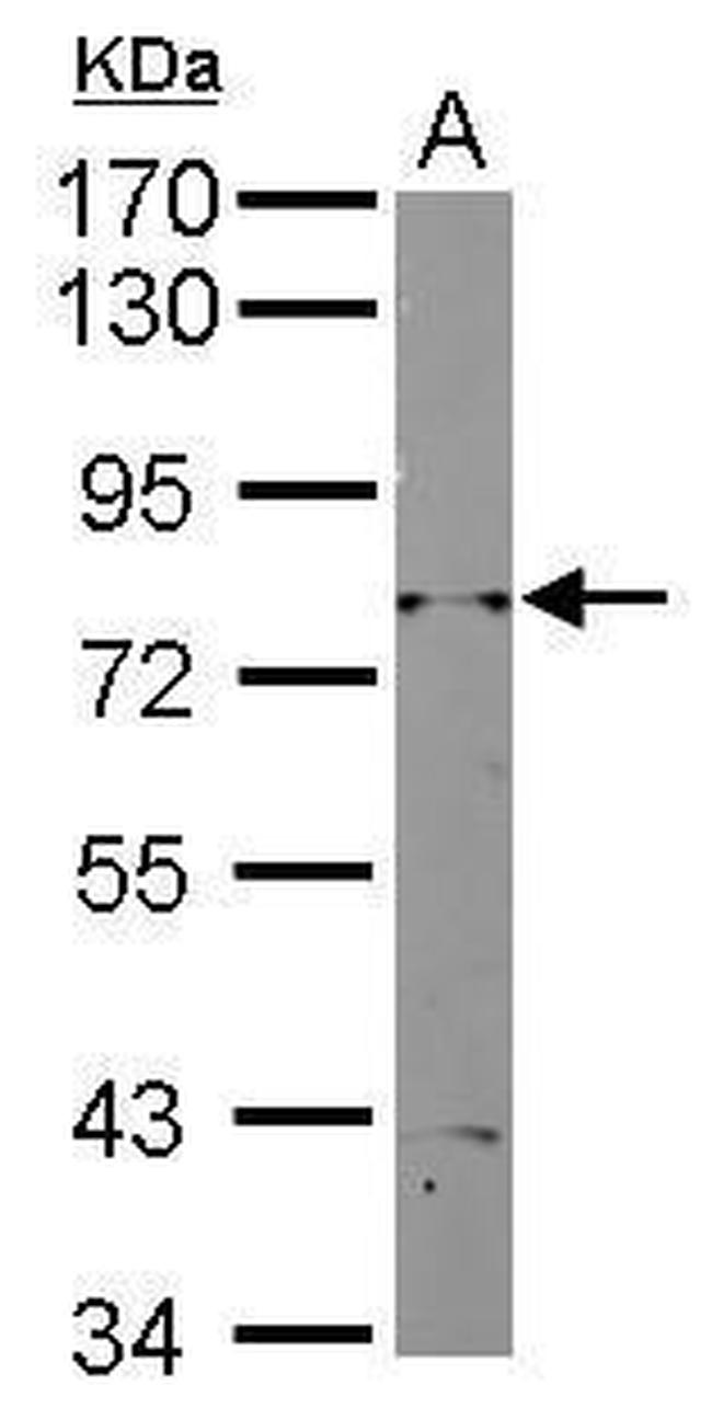 RAD3 Antibody in Western Blot (WB)
