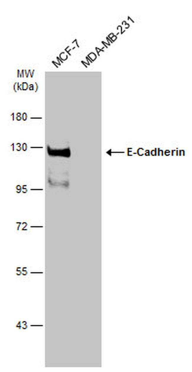 E-cadherin Antibody in Western Blot (WB)