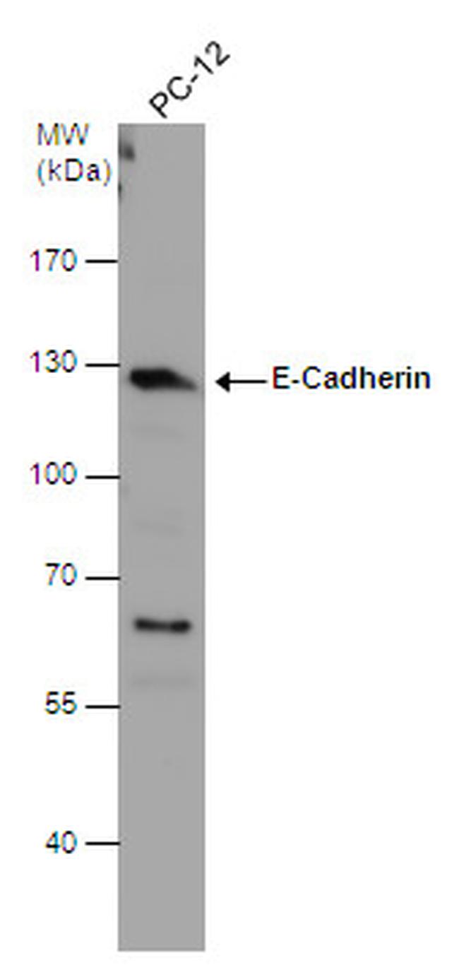 E-cadherin Antibody in Western Blot (WB)