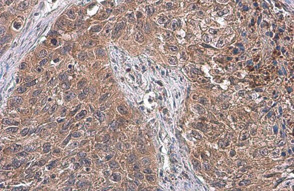 ATG12 Antibody in Immunohistochemistry (Paraffin) (IHC (P))