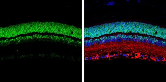 CRX Antibody in Immunohistochemistry (Paraffin) (IHC (P))