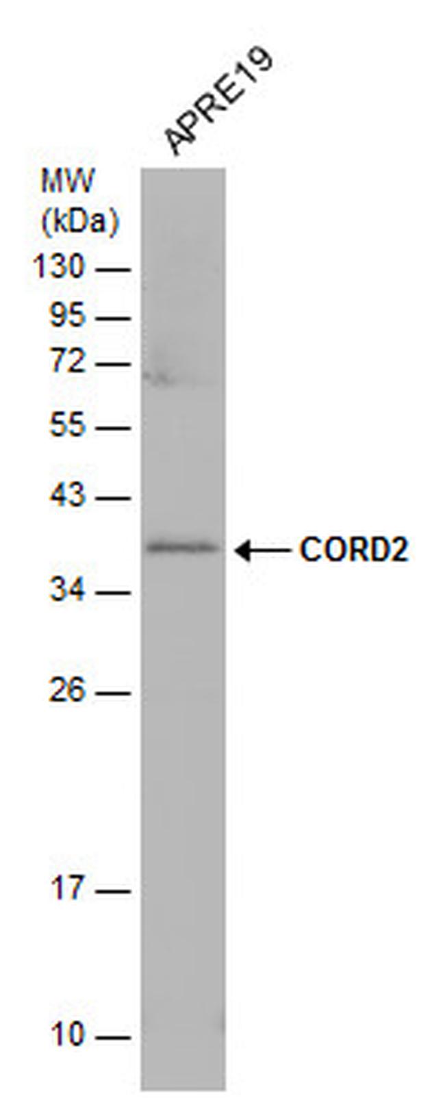 CRX Antibody in Western Blot (WB)