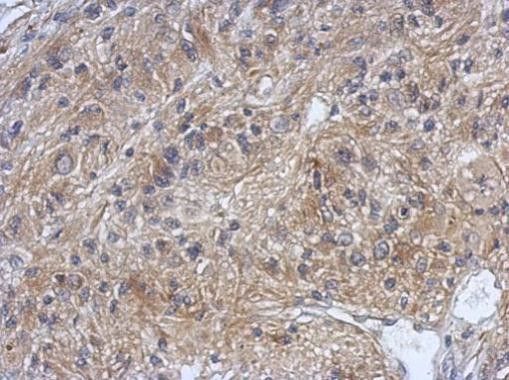 DZIP3 Antibody in Immunohistochemistry (Paraffin) (IHC (P))