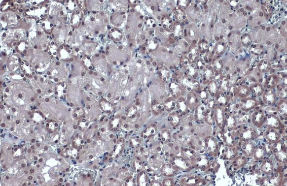 JMJD3 Antibody in Immunohistochemistry (Paraffin) (IHC (P))