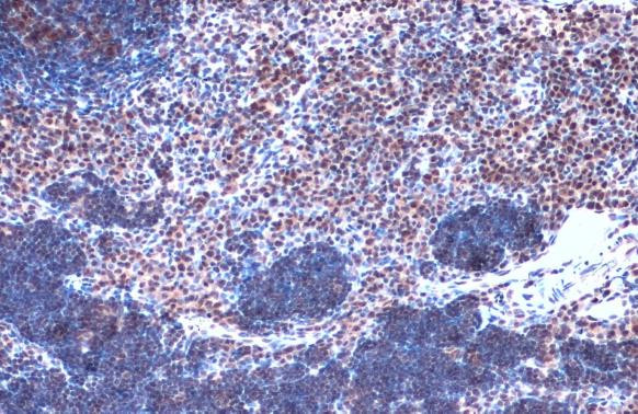 JMJD3 Antibody in Immunohistochemistry (Paraffin) (IHC (P))