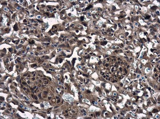 CTGF Antibody in Immunohistochemistry (Paraffin) (IHC (P))