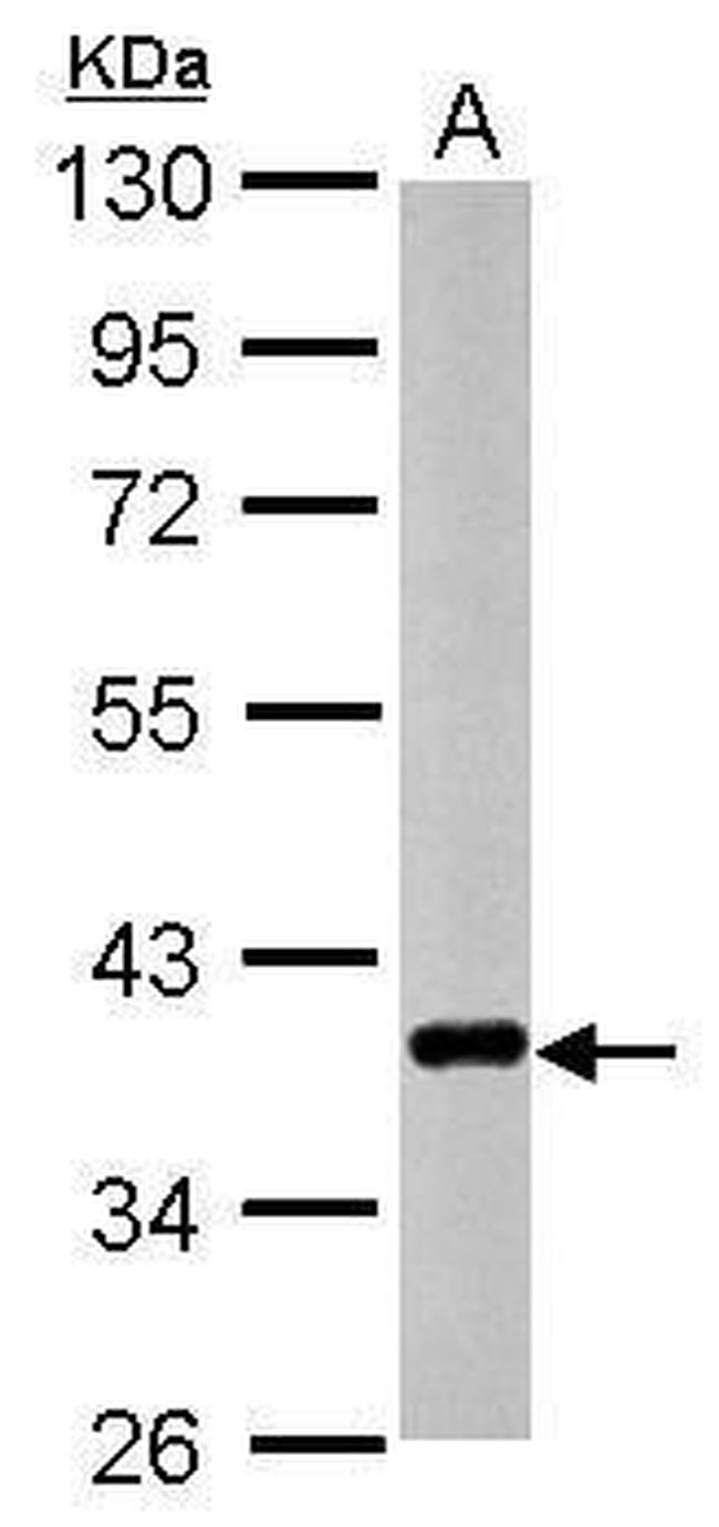 CTGF Antibody in Western Blot (WB)