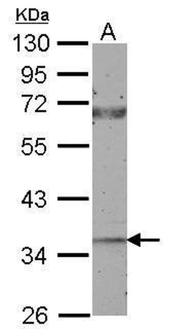 CTGF Antibody in Western Blot (WB)