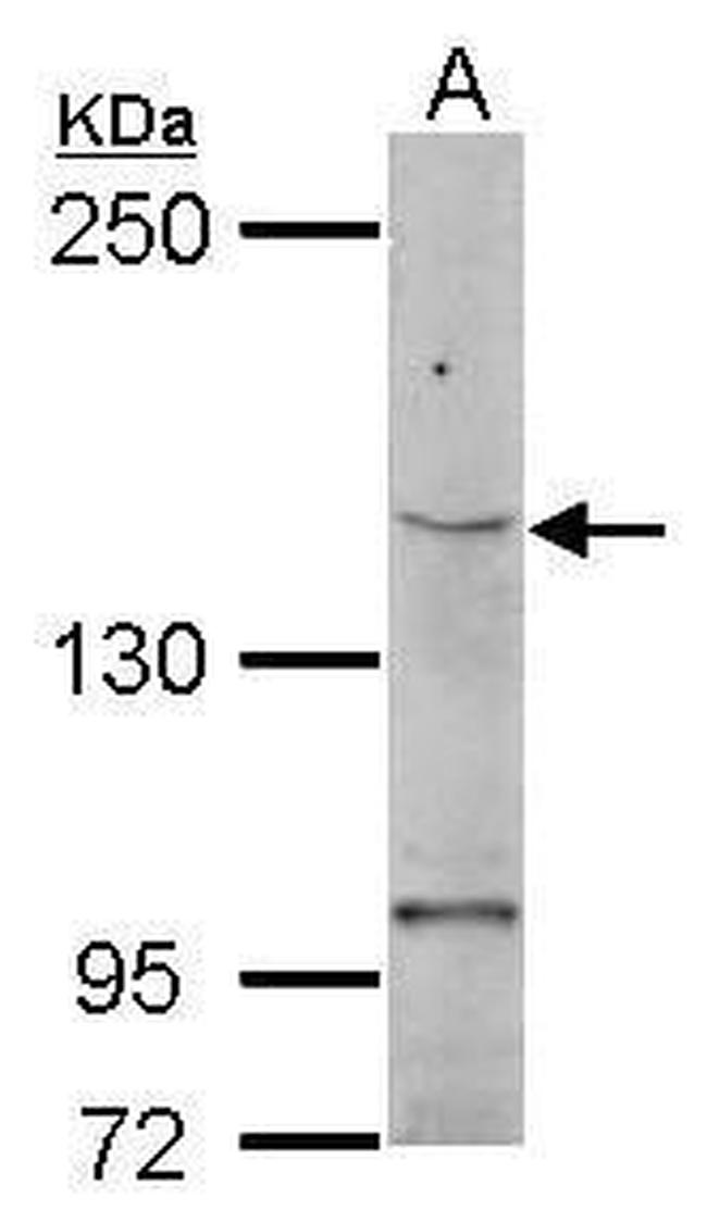 TERT Antibody in Western Blot (WB)