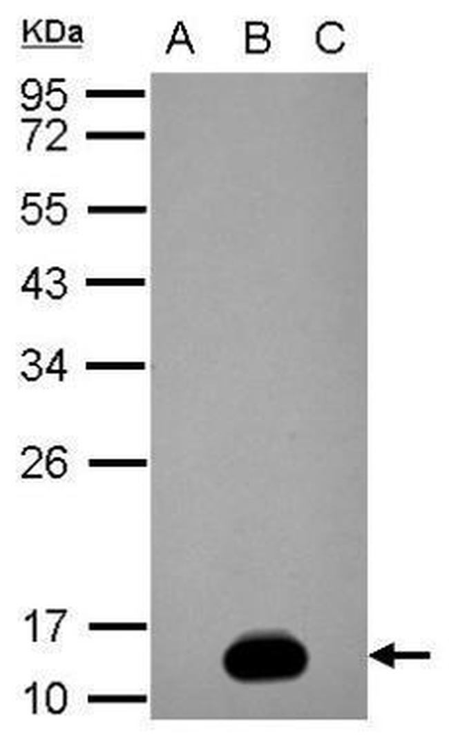 Dengue Virus Type 2 NS2B Antibody in Western Blot (WB)